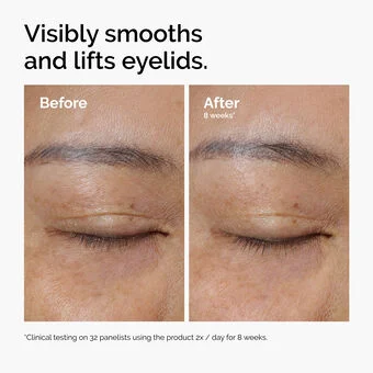 The Ordinary Lacto-PDRN* 4% + B9 Eye Cream - Image 16