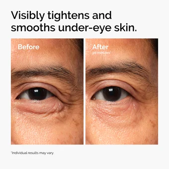 The Ordinary Lacto-PDRN* 4% + B9 Eye Cream - Image 15