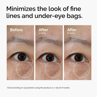 The Ordinary Lacto-PDRN* 4% + B9 Eye Cream - Image 17