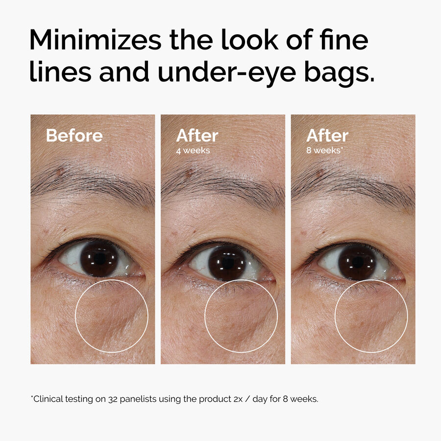 The Ordinary Lacto-PDRN* 4% + B9 Eye Cream - Image 7