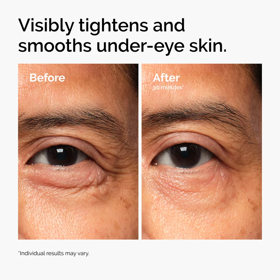 The Ordinary Lacto-PDRN* 4% + B9 Eye Cream - Image 5